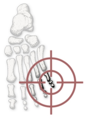 foot 